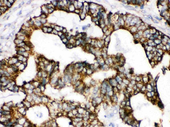 Anti-TRAP1 Antibody
