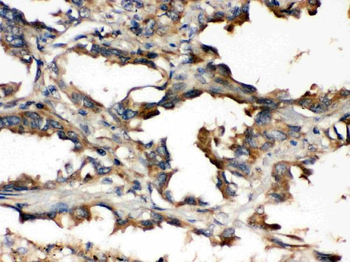 Anti-UBE2Q2 Antibody