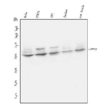 UPF3B/RENT3B Antibody