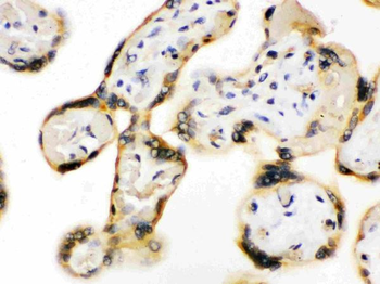 Anti-UPF3B/RENT3B Antibody