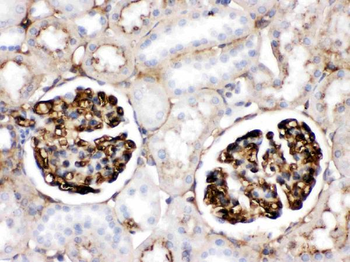 Anti-Apolipoprotein A I/APOA1 Antibody