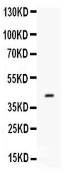 Anti-Factor D/CFD Antibody