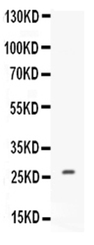 Anti-CNTF Antibody