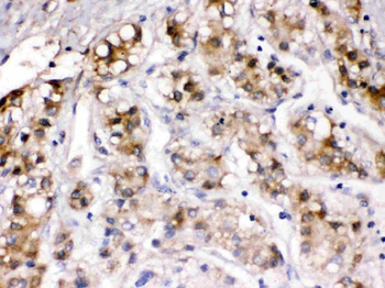 Anti-Ceruloplasmin/CP Antibody