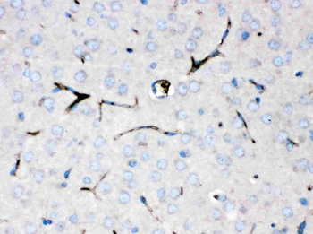 Anti-Ceruloplasmin/CP Antibody