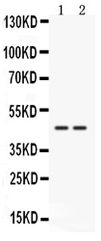 Cathepsin K/CTSK Antibody