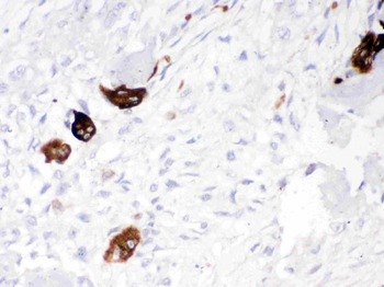 Anti-Cathepsin K/CTSK Antibody