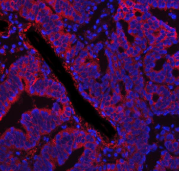 Anti-Fatty Acid Synthase/FASN Antibody