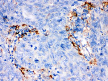 Anti-FCGRT Antibody