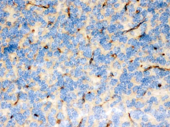Anti-FCGRT Antibody