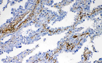 Anti-VEGFD/FIGF Antibody