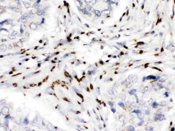 Anti-MDMX/MDM4 Antibody