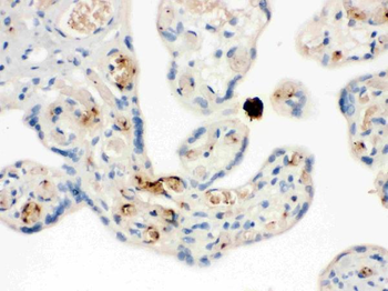 Anti-NAP2/PPBP Antibody