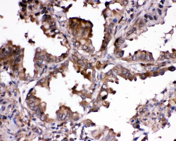 Anti-Ribonuclease Inhibitor/RNH1 Antibody