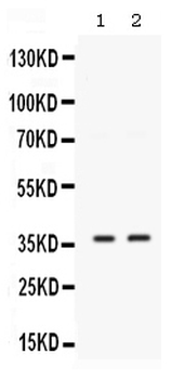 Anti-SIX1 Antibody