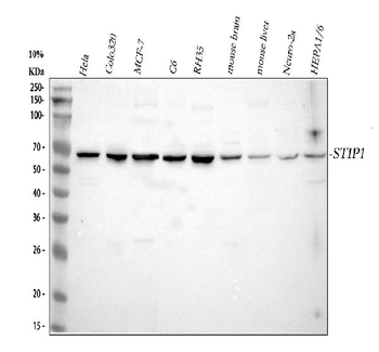 Anti-STIP1 Antibody