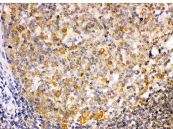 Anti-TRIB2 Antibody