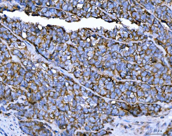 Anti-TRPM4 Antibody