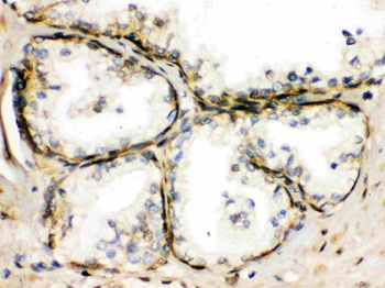 Anti-TRPM5 Antibody