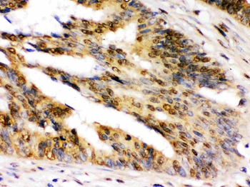Anti-NIRF/UHRF2 Antibody