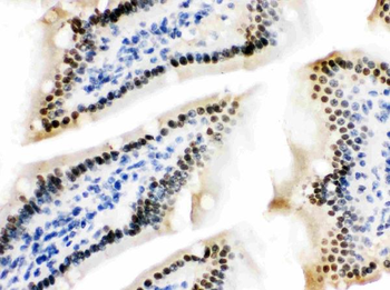 Anti-ZBTB7A Antibody