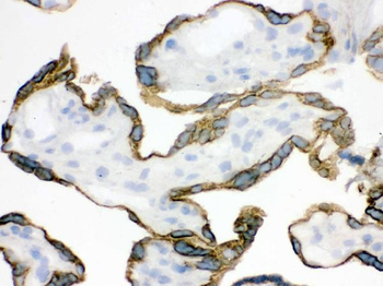 Anti-ZP2 Antibody