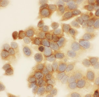 Anti-SIAH Interacting Protein/CACYBP Antibody