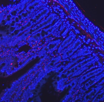 Anti-VIP peptides VIP Antibody