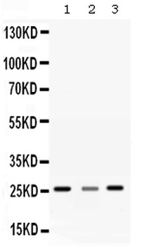 Anti-SR1/SRI Antibody