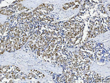 Anti-ABL2 Antibody