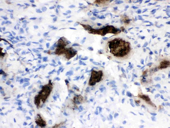 Anti-Osteocalcin/BGLAP Antibody