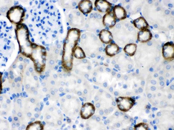 Anti-Calcium Sensing Receptor/CASR Antibody