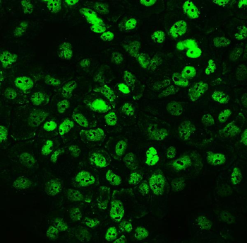 Anti-CCT3 Antibody
