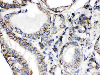 Anti-Calcitonin/CALCA Antibody