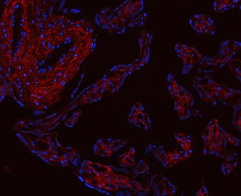 Anti-Collagen I/COL1A1 Antibody