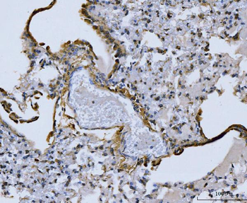Anti-Collagen I/COL1A1 Antibody