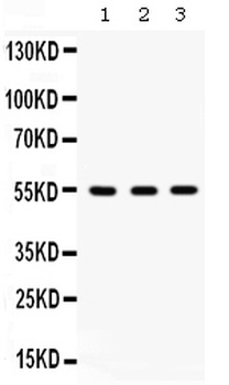 Integrin linked ILK Antibody
