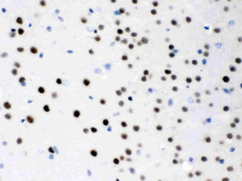 Anti-MEF2A Antibody