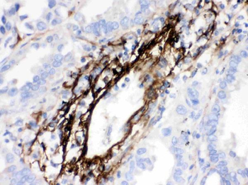 Anti-MGP Antibody