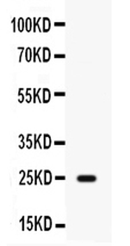 Anti-HE4/WFDC2 Antibody