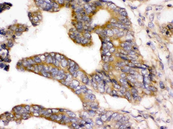 Anti-WNK1 Antibody