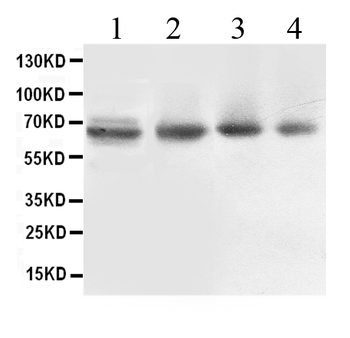 Anti-ABCB10 Antibody