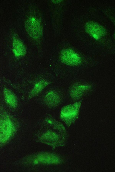 Anti-TCP1 beta/CCT2 Antibody