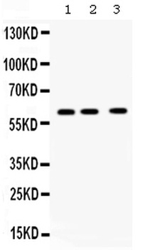 TCP1 theta/CCT8 Antibody