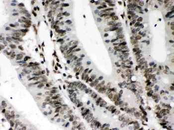 Anti-CIITA Antibody
