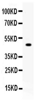 Carboxypeptidase B2/CPB2 Antibody