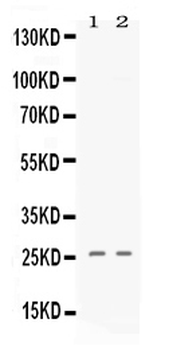 Anti-PF4 Antibody