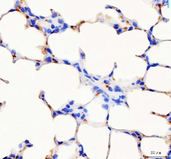 Anti-PF4 Antibody