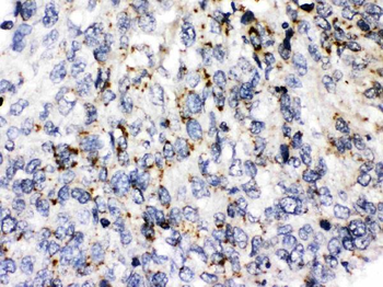 Anti-Perilipin 3/PLIN3 Antibody