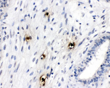 Anti-Mast Cell Tryptase/TPSAB1 Antibody